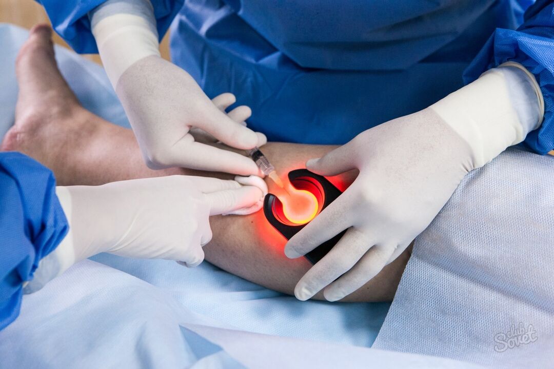 Varicose veins in diagnostic legs