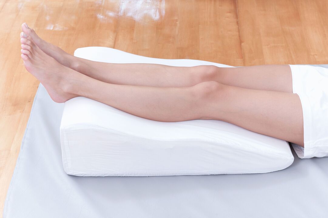 Varicose veins prevention