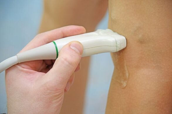 Ultrasound of the veins